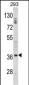 DLX2 Antibody (Center)